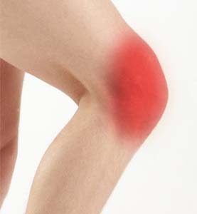 Anterior knee pain