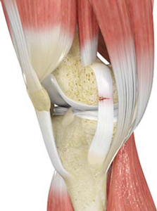 Ligament Injuries  